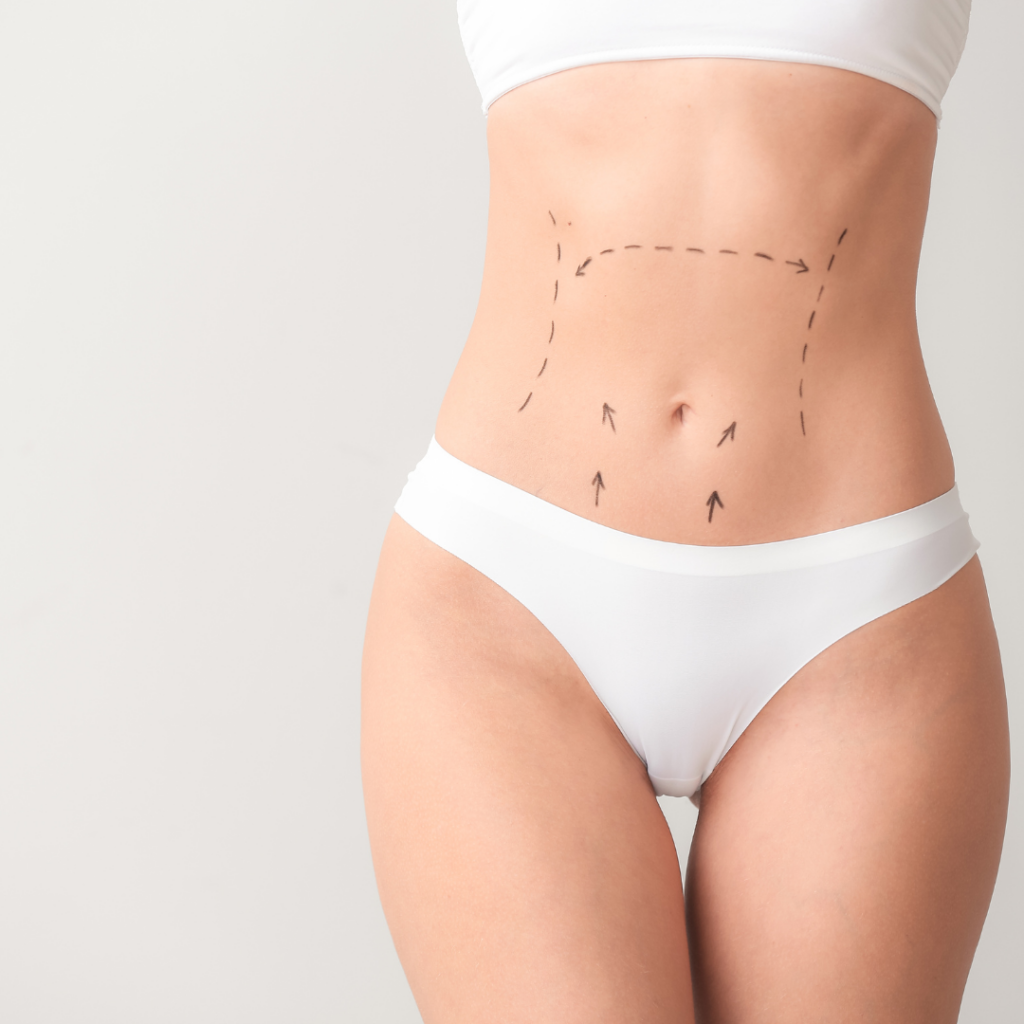 Liposuction Vs. CoolSculpting The Bend Magazine